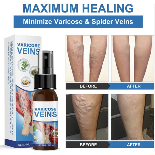 Varicose Veins (SPRAY ANTIVARICES)