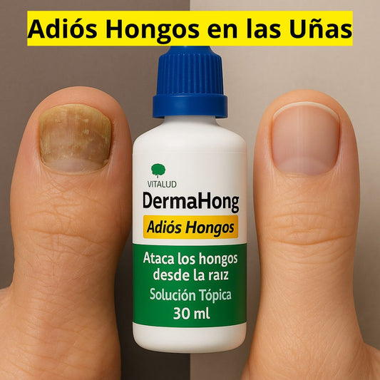 DERMAHONG 2x1 💅 Adiós a los Hongos de Uñas en Pocas Semanas
